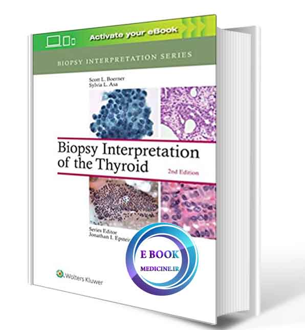 دانلود کتاب Biopsy Interpretation of the Thyroid (Biopsy Interpretation Series) 2016 ( PDF) 